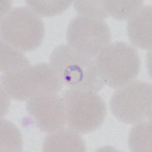 Case377_A.jpg