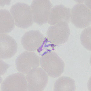 Case377_B.jpg