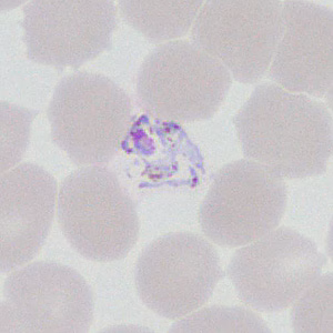 Case377_C.jpg