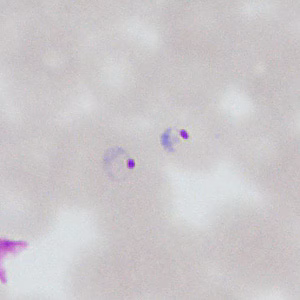 Case377_E.jpg