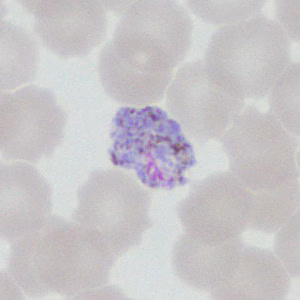 Case377_H.jpg