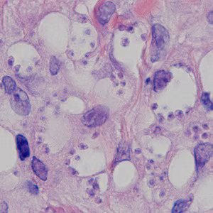 Case378_A.jpg