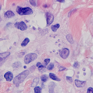 Case378_B.jpg