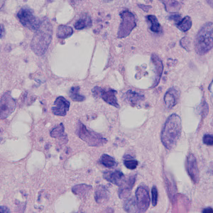 Case378_C.jpg