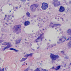 Case378_D.jpg