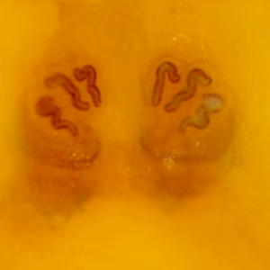 Case379_B.jpg