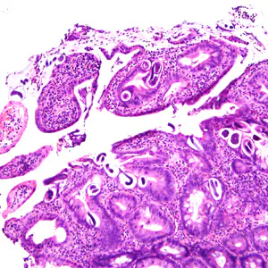 Case380_A.jpg