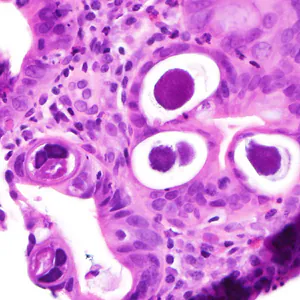Case380_B.jpg