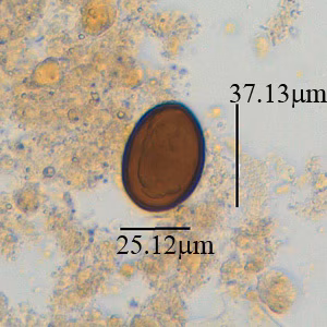 Case381_A.jpg