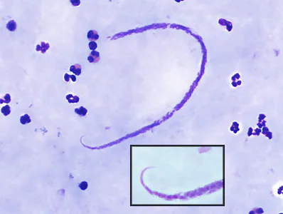 Case382_B.jpg
