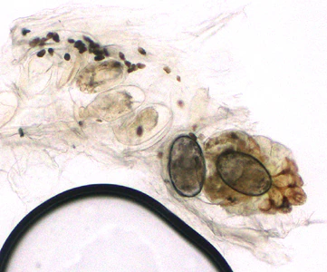Case383_A.jpg