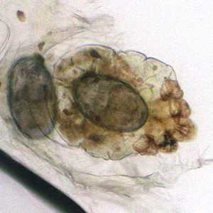 Case383_B.jpg