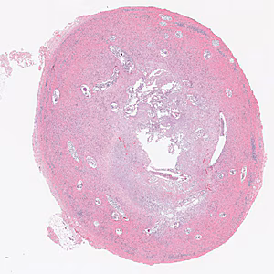 Case384_A.jpg