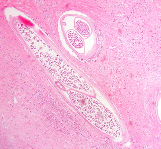 Case384_B.jpg