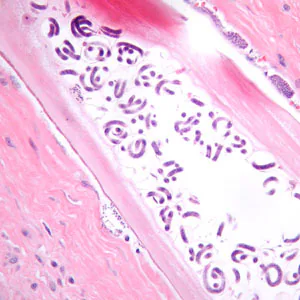 Case384_C.jpg