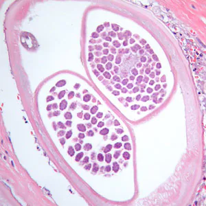 Case384_D.jpg