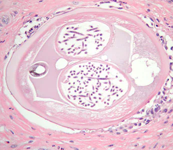 Case384_E.jpg