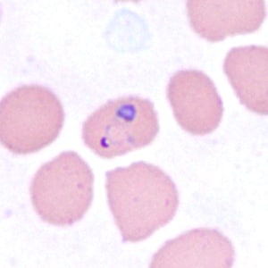 Case385_A.jpg