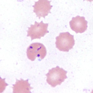 Case385_C.jpg