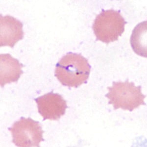 Case385_D.jpg