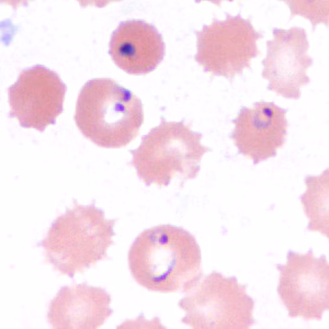 Case385_E.jpg