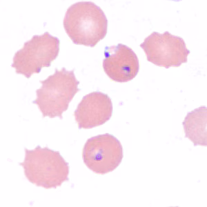 Case385_F.jpg