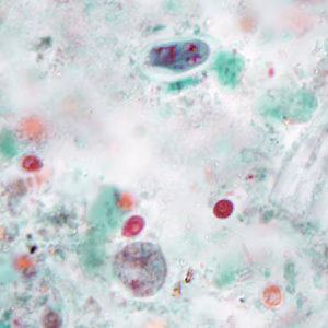 Case386_B.jpg