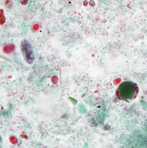 Case386_C.jpg