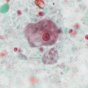 Case386_D.jpg
