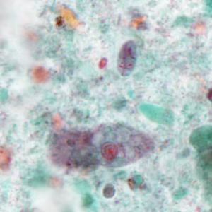 Case386_E.jpg
