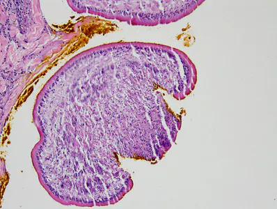 Case387_B.jpg