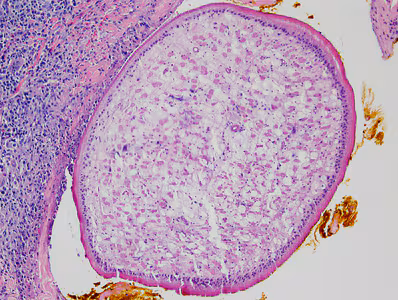 Case387_C.jpg