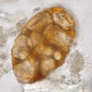 Case388_C.jpg