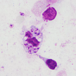 April - 2015 - Case #394