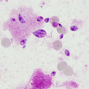 Case394_B.jpg