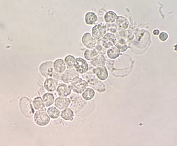 May - 2015 - Case #396