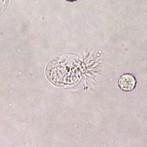 Case396_B.jpg