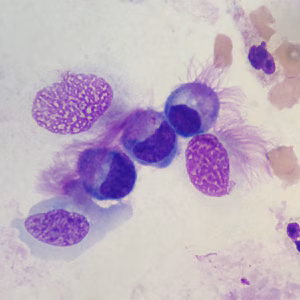 Case396_C.jpg