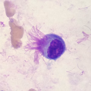 Case396_D.jpg