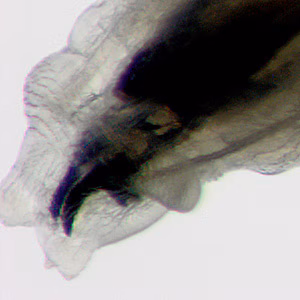 Case397_B.jpg