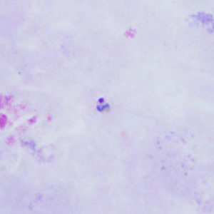 June - 2015 - Case #398