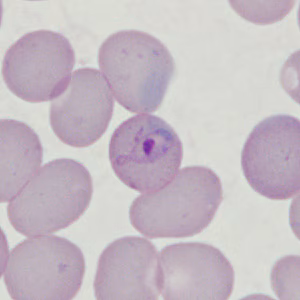 Case398_C.jpg