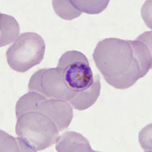 Case398_D.jpg