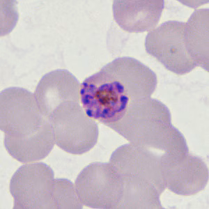 Case398_F.jpg