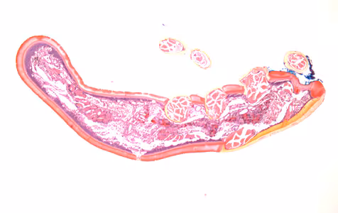July - 2015 - Case #399