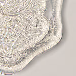Case401_E.jpg
