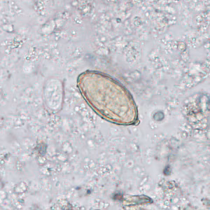 Case402_A.jpg