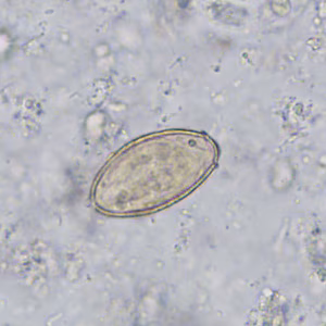 Case402_B.jpg