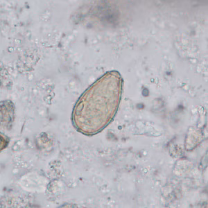 Case402_C.jpg