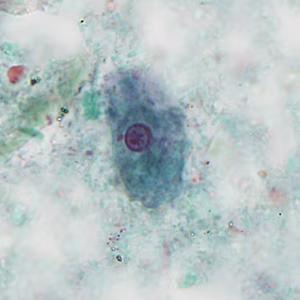 Case404_C.jpg